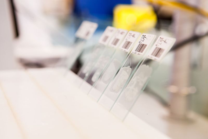 opgesleepte-coupes-op-objectglaasje-labpon-1c3b69fb Histologie