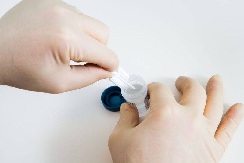 2ebf2af6 Onderzoek baarmoederhalskanker