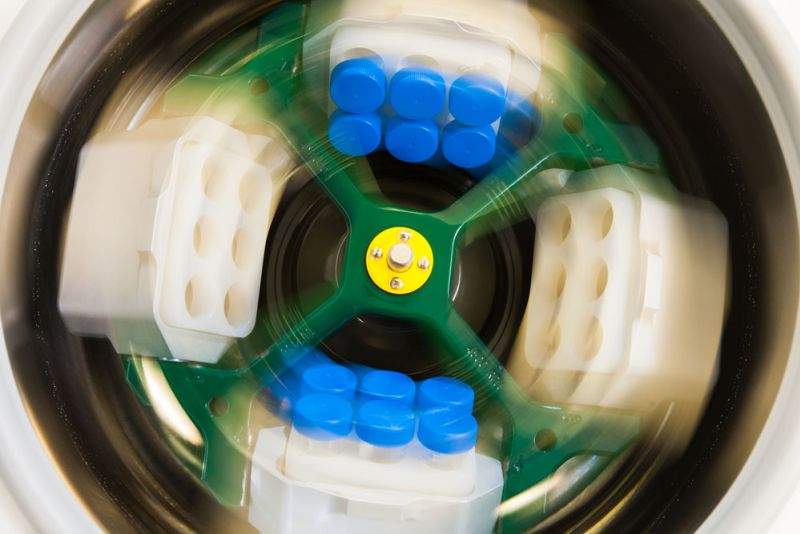 cetrifugeren-materiaal-labpon-51f763d3 Onderzoek baarmoederhalskanker