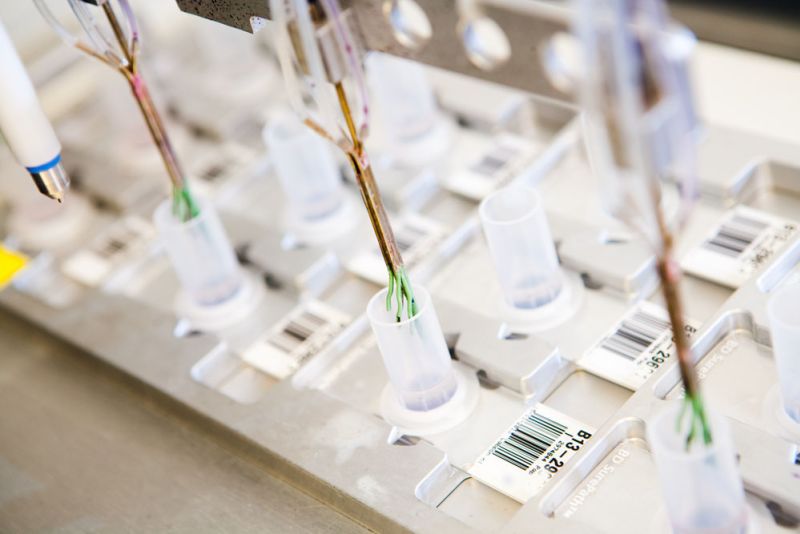 pap-preparaat-kleuren-met-prepstain-labpon-6d59cdce Cytologie