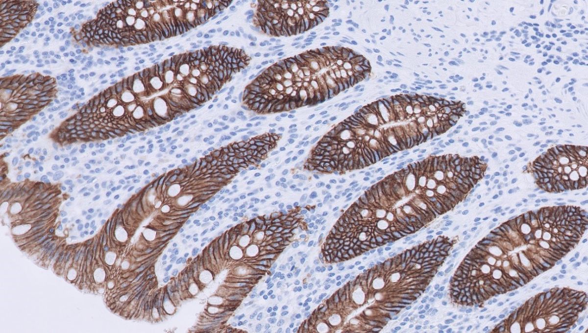 Foto 3 : EPCAM membraneuze kleuring, binnen oppervlak (epitheel) darmweefsel.
