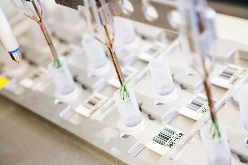 pap-kleuren-preparaten-prepstain-labpon-ab94ba5c Onderzoek baarmoederhalskanker