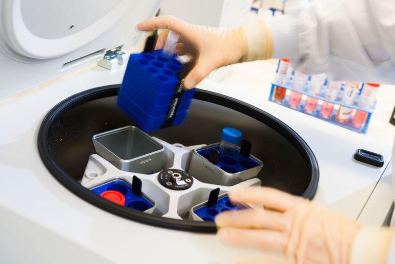 plaatsen-in-centrifuge-labpon-ee6df6d2 Onderzoek baarmoederhalskanker
