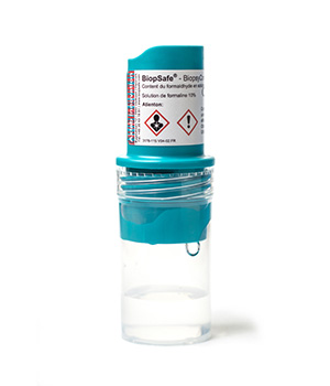 BiopSafe Biopsy Container