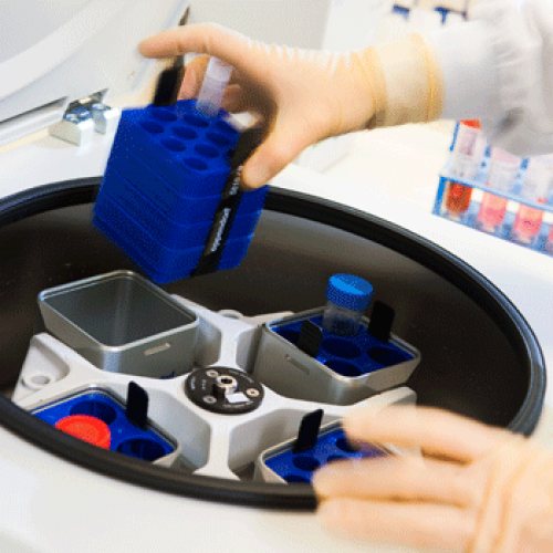 centrifuge-urinebuizen-huisartsen-350px_f169c02324e2b4a51642672fd7e77361 image Inzenden urine door huisartsen Inzenden urine door huisartsen