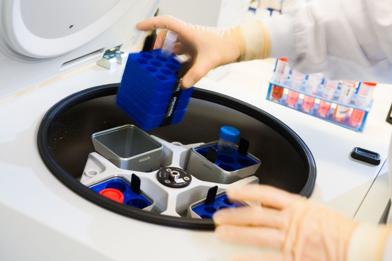 plaatsen-in-centrifuge-labpon-0df7e0ab Onderzoek baarmoederhalskanker